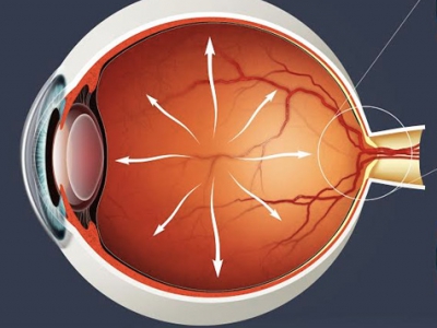 Circle P Glaucoma 01
